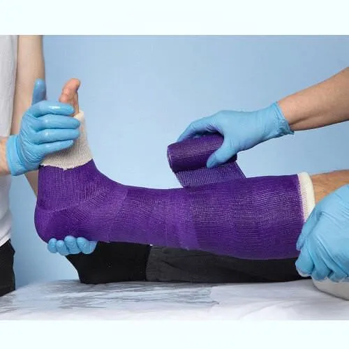 BeneCast Select - Polyester Casting Tape